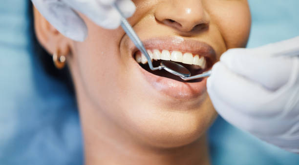 Best Emergency Dentist for Special Needs Patients in Coosada, AL